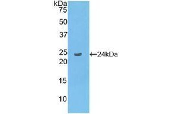 LAT2 Antikörper  (AA 30-209)