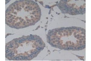 Detection of MAPT in Rat Testis Tissue using Polyclonal Antibody to Tau Protein (MAPT) (tau antibody  (AA 34-368))