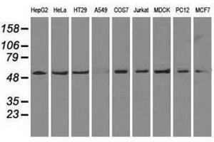 Image no. 4 for anti-ATP Synthase, H+ Transporting, Mitochondrial F1 Complex, beta Polypeptide (ATP5B) antibody (ABIN1496766) (ATP5B antibody)