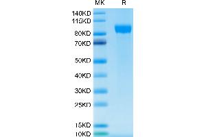 Human Her2 on Tris-Bis PAGE under reduced condition. (ErbB2/Her2 Protein (AA 23-652) (His-Avi Tag))