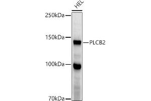 Western blot analysis of extracts of HEL cells, using PLCB2 antibody (ABIN6133052, ABIN6145747, ABIN6145748 and ABIN6224164) at 1:1000 dilution. (Phospholipase C beta 2 antibody  (AA 1-199))