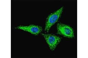 Fluorescent confocal image of HeLa cells stained with anti-Alkaline Phosphatase antibody at 1:100. (Alkaline Phosphatase antibody  (AA 274-304))