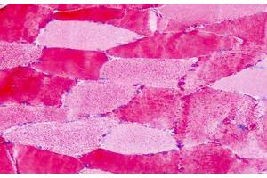 Anti-GPR30 antibody IHC staining of human skeletal muscle.