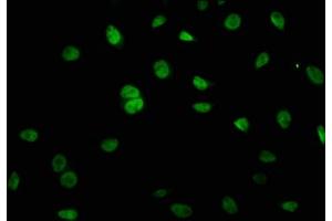 Immunofluorescence staining of A549 cells with ABIN7158687 at 1:66, counter-stained with DAPI. (KRCC1 antibody  (AA 1-259))