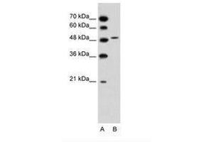 Image no. 2 for anti-Solute Carrier Family 10 (Sodium/bile Acid Cotransporter Family), Member 5 (SLC10A5) (AA 351-400) antibody (ABIN205007) (SLC10A5 antibody  (AA 351-400))