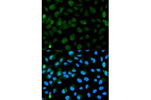 Immunofluorescence analysis of HeLa cell using PML antibody.