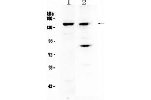 Western blot analysis of FBXL11 using anti-FBXL11 antibody .
