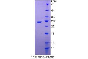 SDS-PAGE analysis of Mouse IL17RE Protein.