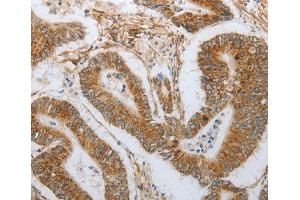 Immunohistochemistry (IHC) image for anti-Neurogenin 1 (NEUROG1) antibody (ABIN3017394) (Neurogenin 1 antibody)