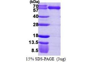 SDS-PAGE (SDS) image for Lysyl-tRNA Synthetase (KARS) (AA 63-597) protein (His tag) (ABIN667520) (KARS Protein (AA 63-597) (His tag))
