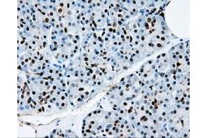 Immunohistochemical staining of paraffin-embedded colon tissue using anti-RPA2mouse monoclonal antibody. (RPA2 antibody)