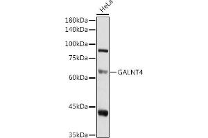 Western blot analysis of extracts of HeLa cells, using G antibody (ABIN6135078, ABIN6140946, ABIN7101653 and ABIN7101654) at 1:1000 dilution.