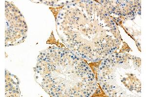 ABIN6261393 and ABIN6273233 at 1/100 staining Mouse testis tissue by IHC-P.