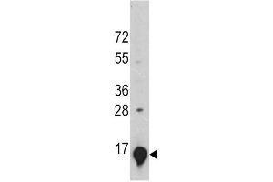A375 cell lysates probed with GLT (24CT661. (SLC1A2 antibody)