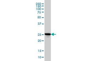 RAB27A monoclonal antibody (M02), clone 1G7 Western Blot analysis of RAB27A expression in HL-60 . (RAB27A antibody  (AA 122-221))