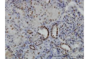 Immunoperoxidase of monoclonal antibody to SGK on formalin-fixed paraffin-embedded human kidney. (SGK1 antibody  (AA 1-90))