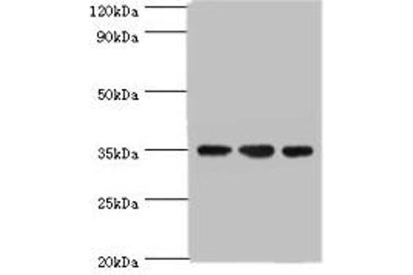 AIMP2 anticorps  (AA 141-320)
