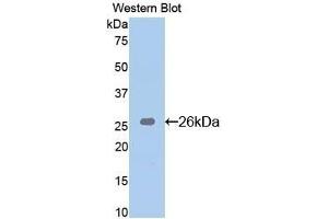 Detection of Recombinant Bid, Mouse using Polyclonal Antibody to BH3 Interacting Domain Death Agonist (Bid) (BID antibody  (AA 1-195))