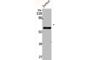 Western Blot analysis of Jurkat cells using CYP2A7 Polyclonal Antibody (CYP2A7 antibody  (C-Term))