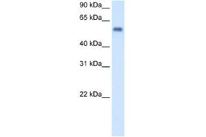 MAOB antibody used at 1 ug/ml to detect target protein. (Monoamine Oxidase B antibody  (C-Term))