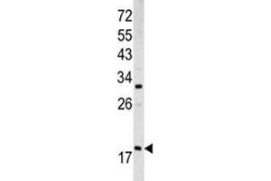 Western blot analysis of ARF3 antibody and MCF-7 lysate (ARF3 antibody  (AA 78-106))