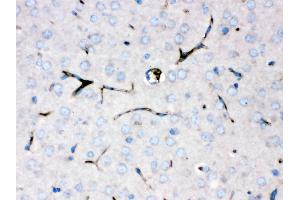 Immunohistochemistry (Paraffin-embedded Sections) (IHC (p)) image for anti-Ceruloplasmin (Ferroxidase) (CP) (AA 20-258) antibody (ABIN3044508)