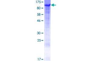 Image no. 1 for Choroideremia-Like (Rab Escort Protein 2) (CHML) (AA 1-656) protein (GST tag) (ABIN1349344) (CHML Protein (AA 1-656) (GST tag))