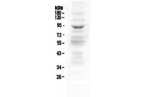 Western blot analysis of MAP3K20 using anti-MAP3K20 antibody . (ZAK antibody  (AA 276-511))