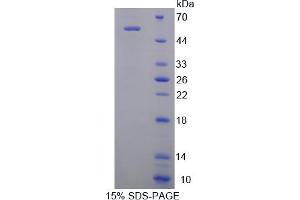 Image no. 1 for MOK Protein Kinase (MOK) (AA 1-237) protein (His tag,GST tag) (ABIN6237543) (MOK Protein (AA 1-237) (His tag,GST tag))