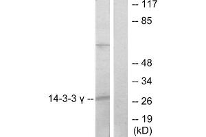 Western blot analysis of extracts from K562 cells, treated with insulin (0. (14-3-3 gamma antibody  (Internal Region))