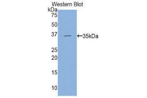 Western Blotting (WB) image for anti-Hexokinase 2 (HK2) (AA 619-917) antibody (ABIN3204500)