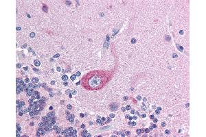 Anti-BRD4 antibody IHC of human brain, cerebellum. (BRD4 antibody  (AA 651-700))