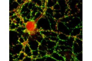 Indirect immunofluorescence labeling of cultured hippocampal neurons with anti-synaptopodin (dilution 1 : 500; red) and anti-synapsin (cat. (SYNPO antibody  (Isoform 2))