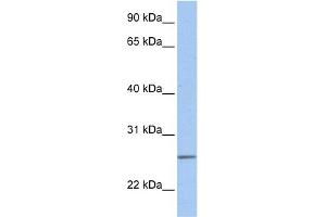WB Suggested Anti-UBE2C Antibody Titration:  0. (UBE2C antibody  (Middle Region))