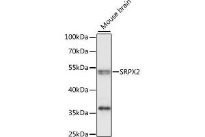 Western blot analysis of extracts of mouse brain, using SRPX2 antibody (ABIN7270653) at 1:1000 dilution. (SRPX2 antibody  (AA 166-465))