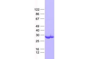 Western Blotting (WB) image for Neural Retina Leucine Zipper (NRL) protein (His tag) (ABIN2727637)
