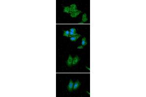 ICC/IF analysis of ACADS in Hep3B cells line, stained with DAPI (Blue) for nucleus staining and monoclonal anti-human ACADS antibody (1:100) with goat anti-mouse IgG-Alexa fluor 488 conjugate (Green). (ACADS antibody)