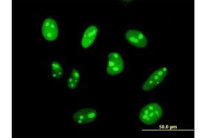 Immunofluorescence of purified MaxPab antibody to DIMT1L on HeLa cell. (DIMT1 antibody  (AA 1-313))