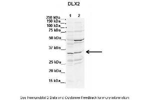 Lanes:  1. (DLX2 antibody  (N-Term))