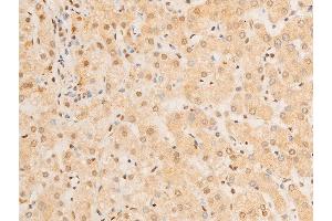 Immunohistochemistry (IHC) image for anti-Forkhead Box O3 (FOXO3) (pSer253) antibody (ABIN6255131)