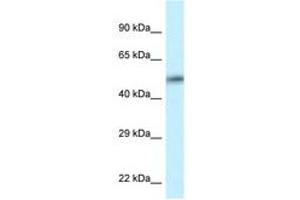 Image no. 1 for anti-Calcium/calmodulin-Dependent Protein Kinase II delta (CAMK2D) (AA 302-351) antibody (ABIN6747600)