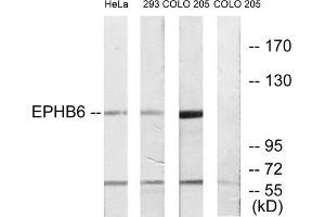 Western blot analysis of extracts from HeLa cells, 293 cells and COLO cells, using EPHB6 antibody. (EPH Receptor B6 antibody  (C-Term))