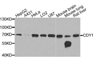 Western blot analysis of extracts of various cell lines, using CDY1 antibody (ABIN6003586) at 1/1000 dilution.