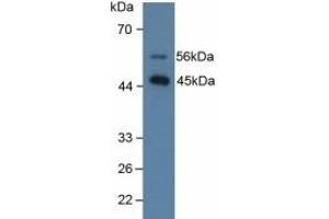Detection of SPD in Human Lung Tissue using Polyclonal Antibody to Surfactant Associated Protein D (SPD) (SFTPD antibody  (AA 21-375))