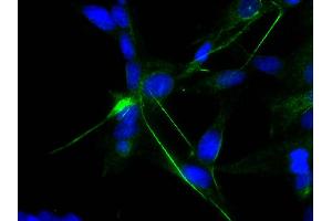 Human astrocytoma cell line CCF-STTG1 was stained with Mouse Anti-Human GFAP-UNLB and DAPI. (GFAP antibody)