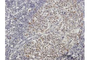 Immunoperoxidase of purified MaxPab antibody to ZNF342 on formalin-fixed paraffin-embedded human lymph node.