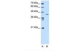 Image no. 1 for anti-Selenophosphate Synthetase 1 (SEPHS1) (C-Term) antibody (ABIN321507) (SEPHS1 antibody  (C-Term))