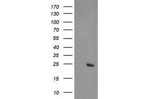 Western Blotting (WB) image for anti-Cyclin-Dependent Kinase Inhibitor 3 (CDKN3) antibody (ABIN1497460) (CDKN3 antibody)
