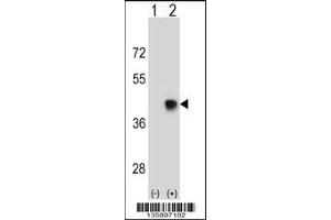 Western blot analysis of SPEM1 using rabbit polyclonal SPEM1 Antibody using 293 cell lysates (2 ug/lane) either nontransfected (Lane 1) or transiently transfected (Lane 2) with the SPEM1 gene. (SPEM1 antibody  (AA 115-143))