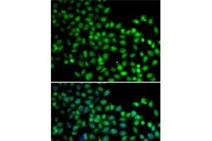 Immunofluorescence analysis of A-549 cells using FKBP6 Polyclonal Antibody (FKBP6 antibody)